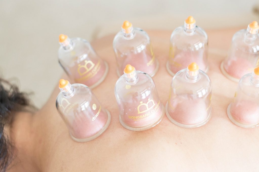 massage, therapy, body, alternative, treatment, cupping, massage, therapy, cupping, cupping, cupping, cupping, cupping